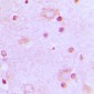 Anti-SRSF7 Antibody